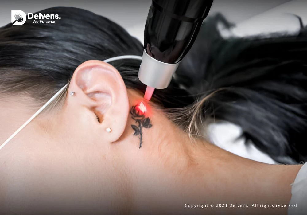 Medical Lasers Market by Share, Size, Revenue, Top Manufacturers and More