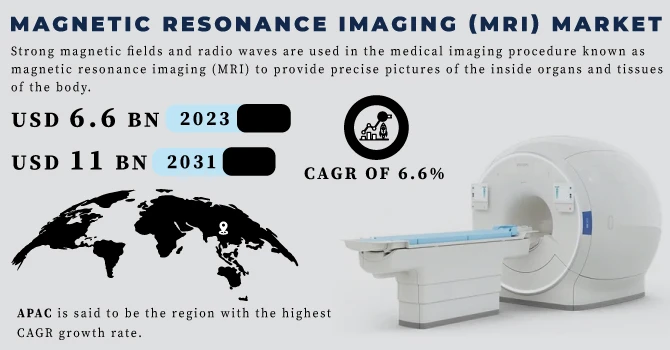 MRI Market Expansion into Emerging Economies