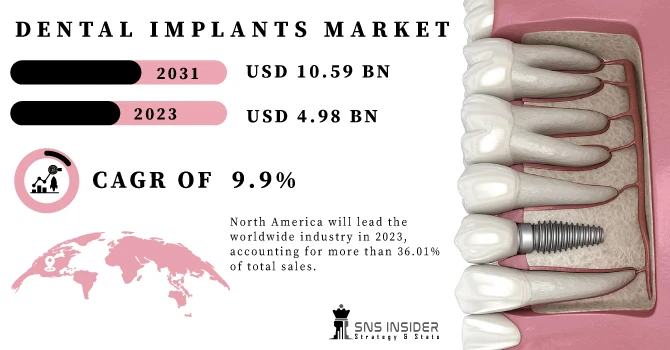 Dental Implants Market Size: Growth Drivers and Challenges