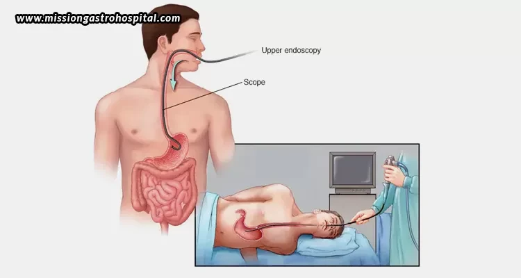 Everything You Need To Know About Endoscopy - Mission Gastro Hospital