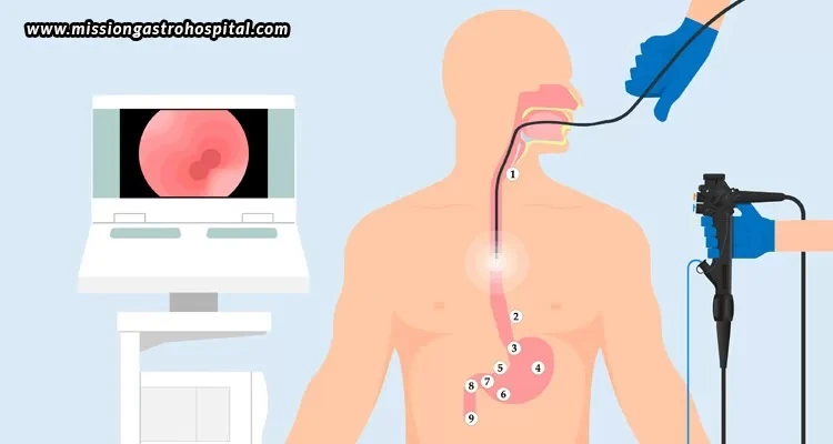 A Comprehensive Guide To Endoscopy In Gastrointestinal Care