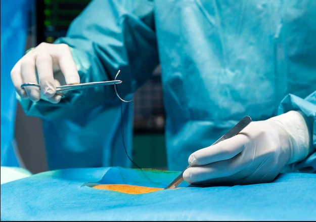 Surgical Sutures Market Size, Share, Demand, Growth Factors, Sales Analysis &amp; Forecast Report 2024-2032