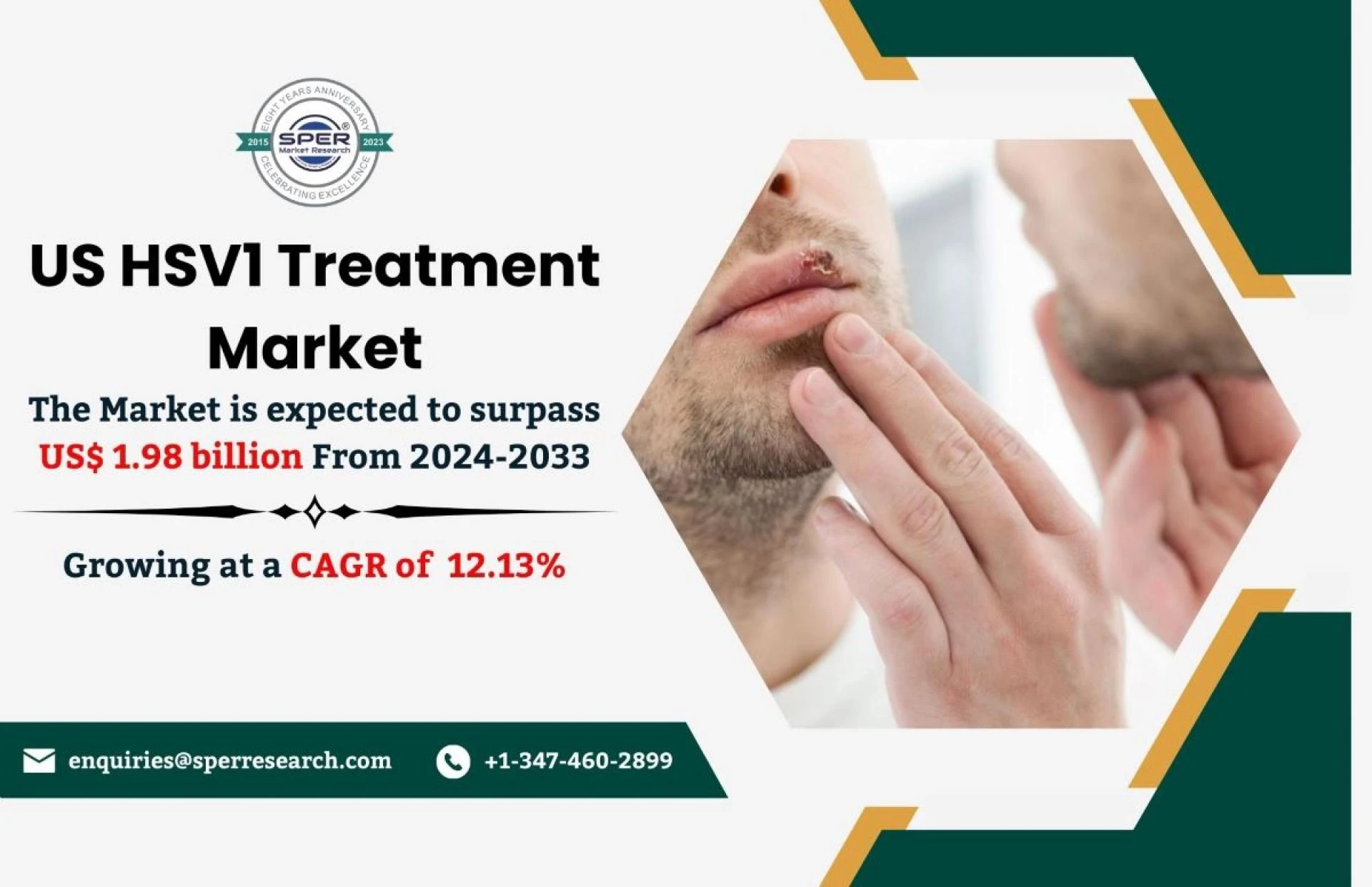 US HSV1 Treatment Market Trends, Growth Drivers, Key Manufactures, Revenue, Demands, Challenges, Opportunities and Forecast Till 2032: SPER Market Research