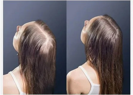 Unveiling The Best Hair Care Treatments in Singapore's Cosmopolitan Landscape