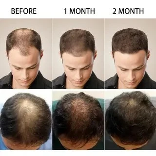 Exploring Hair Care Treatments in Singapore's Cosmopolitan Landscape