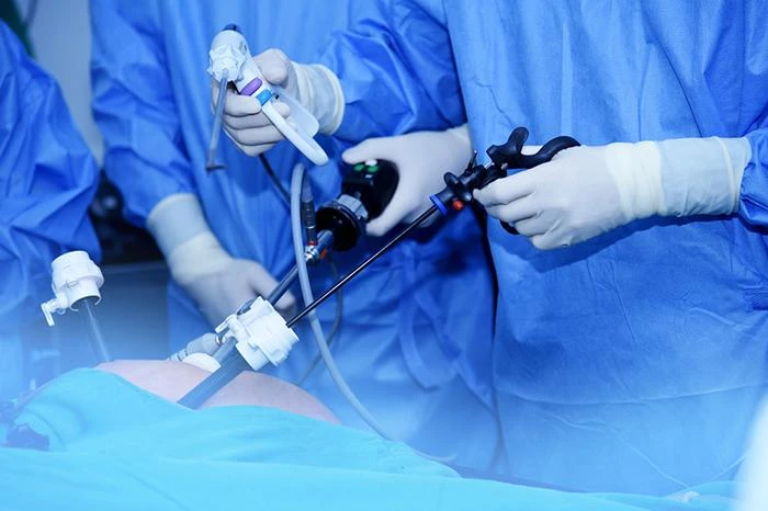 What to Expect During and After Laparoscopic Surgery