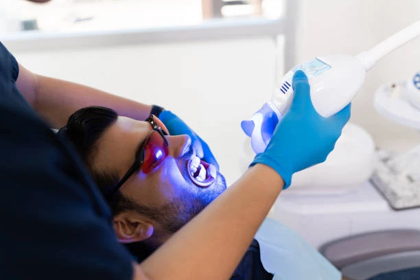 Discover the Best Teeth Whitening in Riyadh: Shine Bright in the Capital