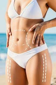 Understanding the Cost of Body Liposuction in Riyadh: What You Need to Know
