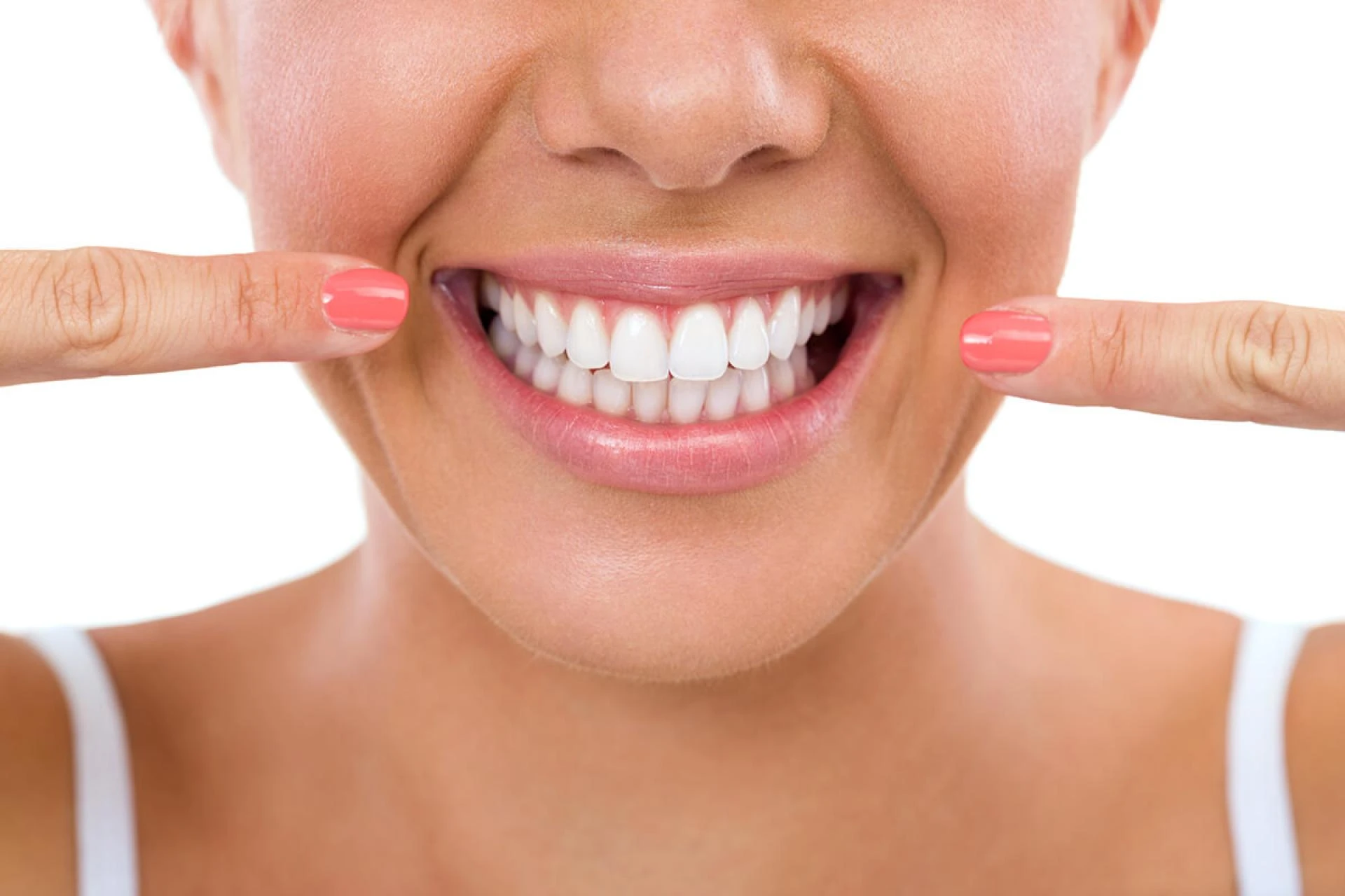 Where to Find Professional Teeth Whitening in Riyadh.