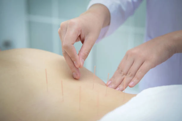 Understanding the Long-Term Benefits of Acupuncture for Weight Loss