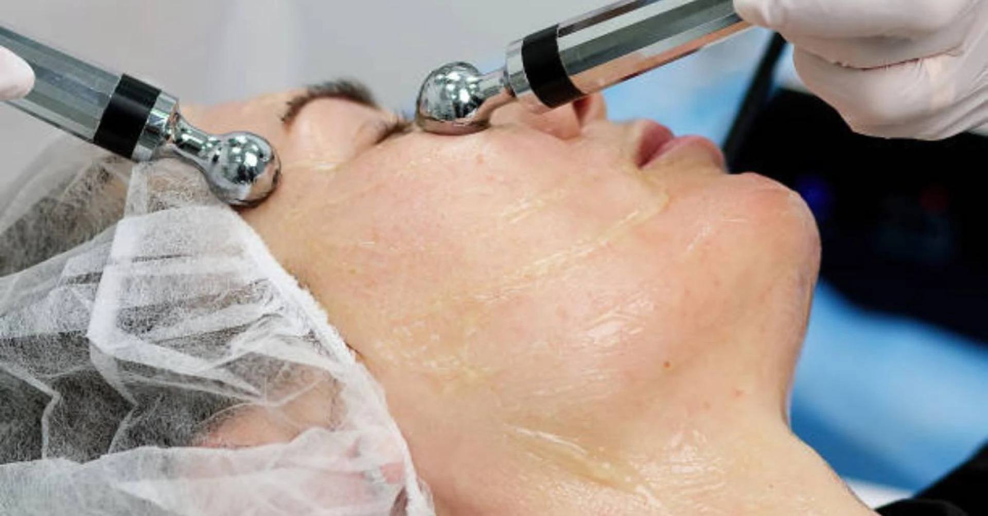 Achieve Radiant Skin with the Cosmelan Depigmentation Peel