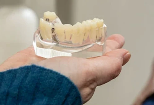 Transform Your Smile with Veneers in Portland