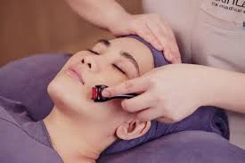 Derma Rollers: A Comprehensive Guide for Riyadh’s Beauty Lovers