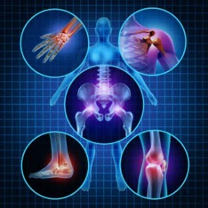 Psoriatic Arthritis Treatment in Surat - Niramay Swasthyam