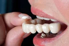 Teeth Crowns in Dubai: Unmatched Quality
