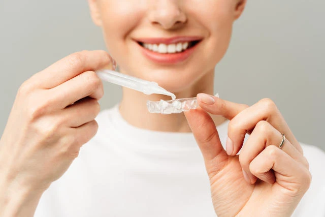 The Secret to a Whiter Smile is Peroxide Teeth Whitening Gel