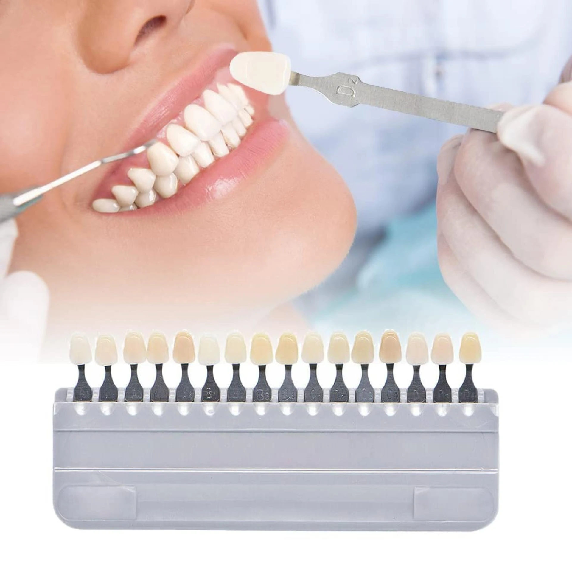 Advice for Safe Use of At-Home Teeth Whitening Kits