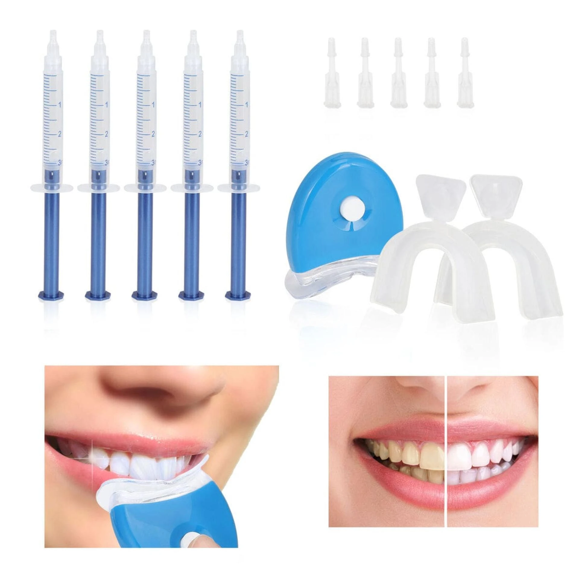 The Most Effective Teeth Whitening Kits: What Dentists Think