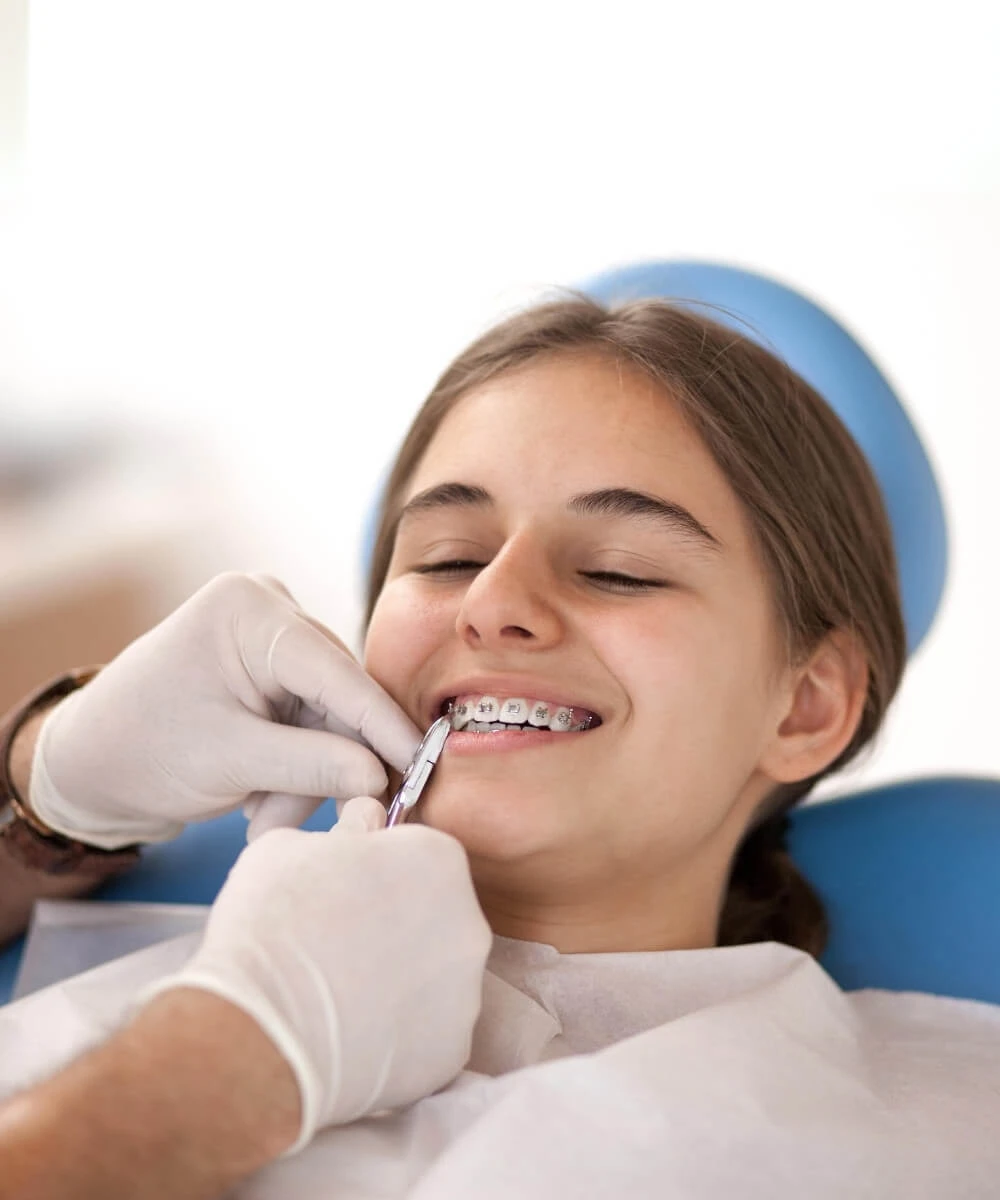 Aligning Misaligned Teeth with Braces