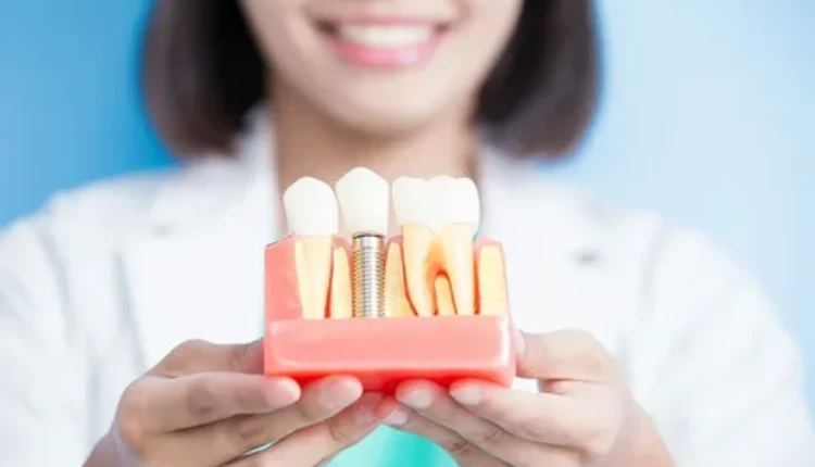 Dental Implants and Social Life: Improving Social Confidence