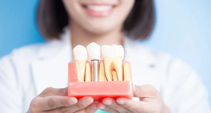 Why You Should Give Importance To Regular Dental Checkup