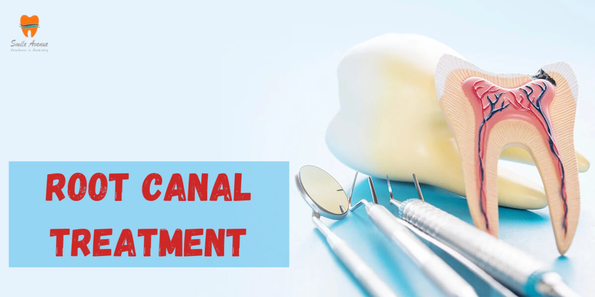 Revolutionizing Dental Care: RCT Treatment Excellence in Noida