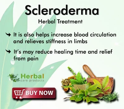 Herbal Treatment for Scleroderma | Remedies | Herbal Care Products