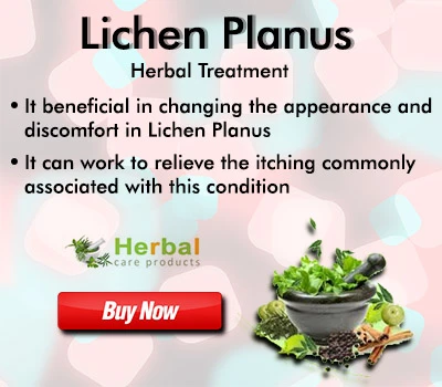 Herbal Treatment for Lichen Planus | Remedies | Herbal Care Products