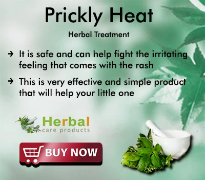 Herbal Treatment for Prickly Heat | Remedies | Herbal Care Products