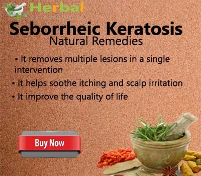 Herbal Treatment for Seborrheic Keratosis - Herbal Care Products