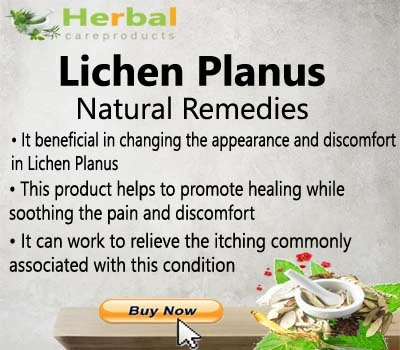 Herbal Treatment for Lichen Planus - Herbal Care Products