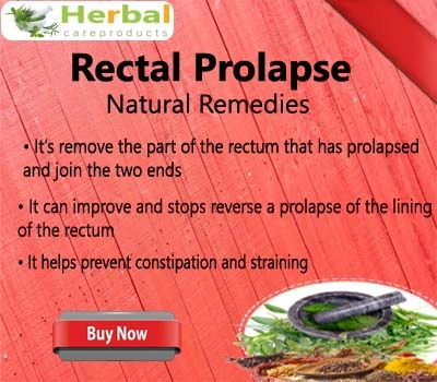 Herbal Treatment for Rectal Prolapse - Herbal Care Products