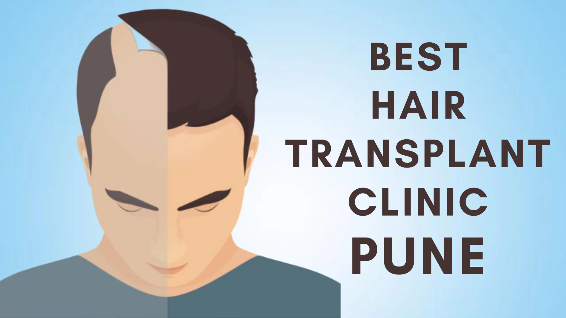 Best Hair Transplant Clinic in Pune