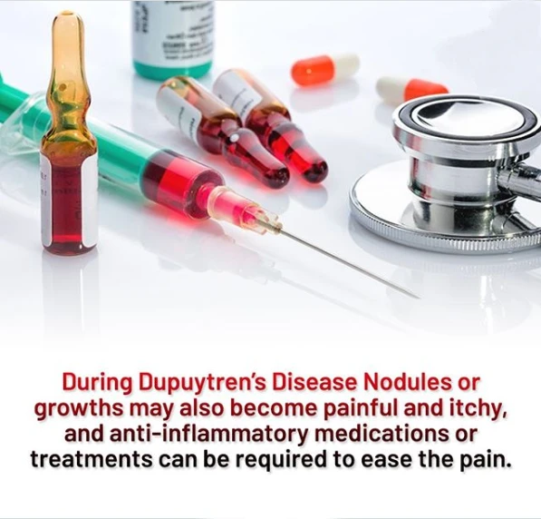Best At-home Dupuytren’s Treatment Provides Relief in no Time!