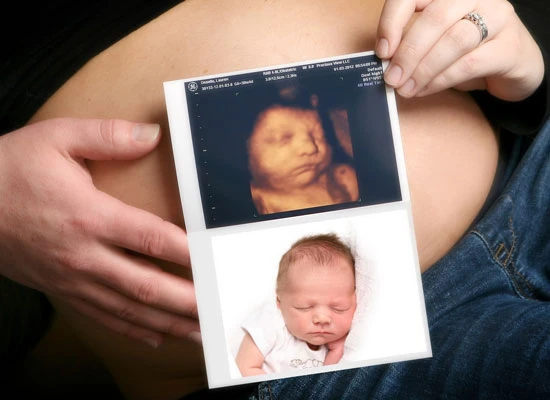 Sonography centre in Udaipur, Ultrasound centre