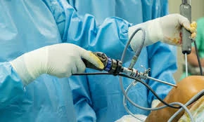 Complete Guide On Shoulder Arthroscopy