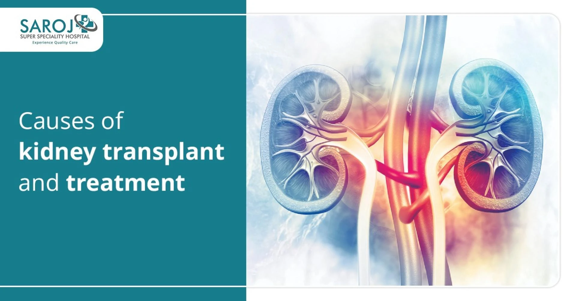 CAUSES OF KIDNEY TRANSPLANT AND TREATMENT