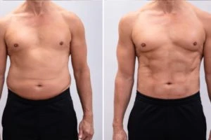 Diet Vs. Exercise: Benefits Of Diet For Weight Loss