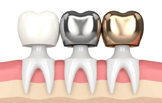 Best Dentist in Ahmedabad