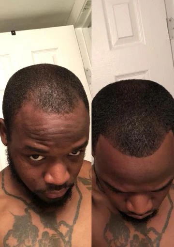 Get Original Wholesale Wild Growth Hair Oil