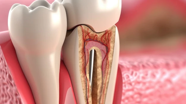 Root Canal Treatment: Facts vs. Fiction
