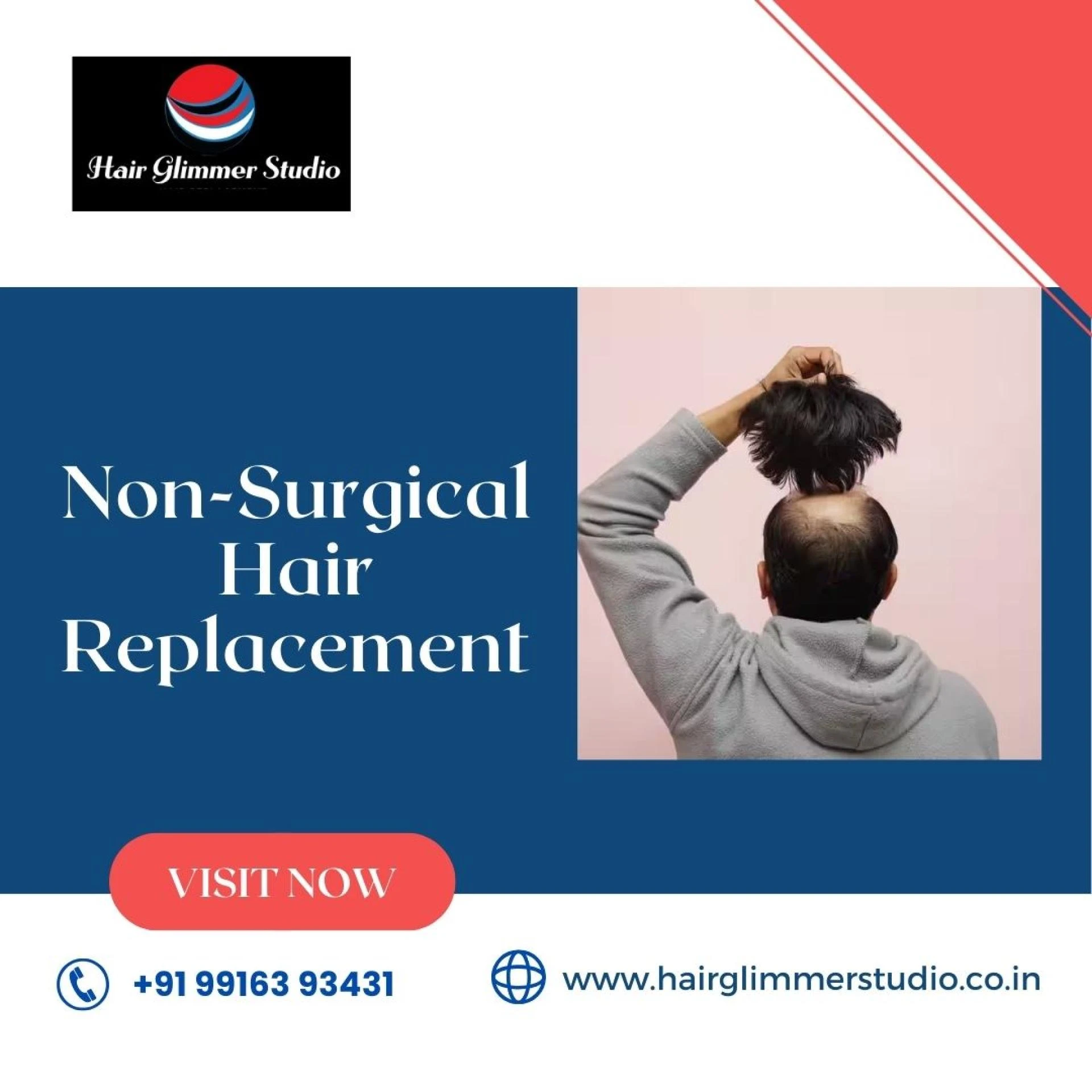 Non-Surgical Hair Replacement: Dos and Don\'ts