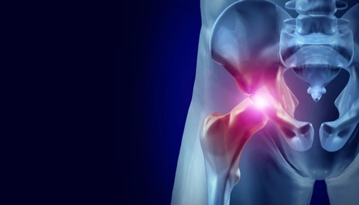 How long does it take to recover from Hip Replacement Surgery?