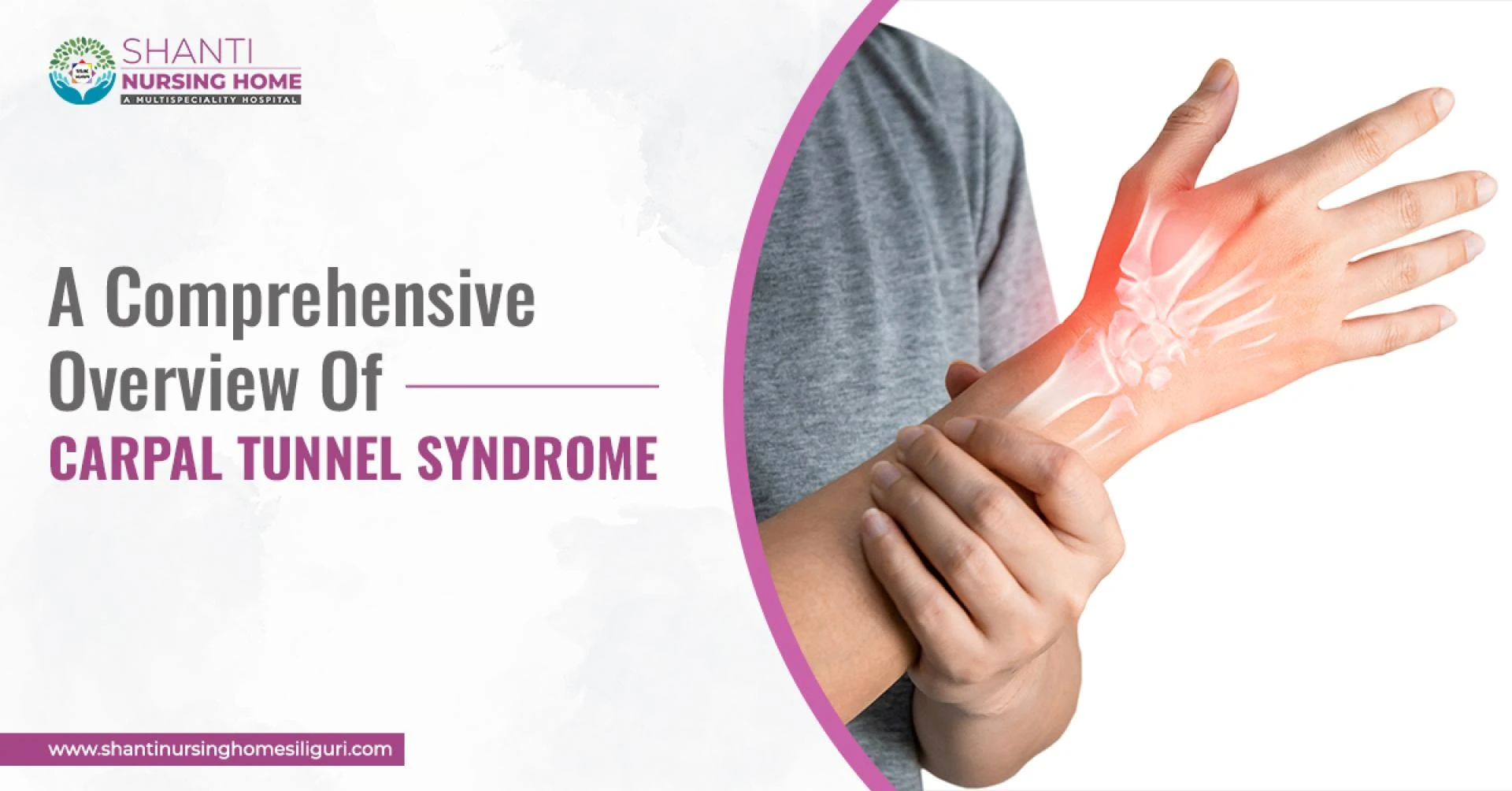 A Comprehensive Overview Of Carpal Tunnel Syndrome