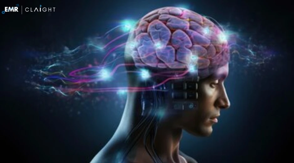 Global Wireless Brain Sensors Market Size, Share, Analysis, Report | 2032