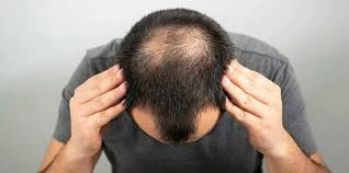 Discover the Leading Hair Transplant Clinics in India: QHT Clinic and Affor