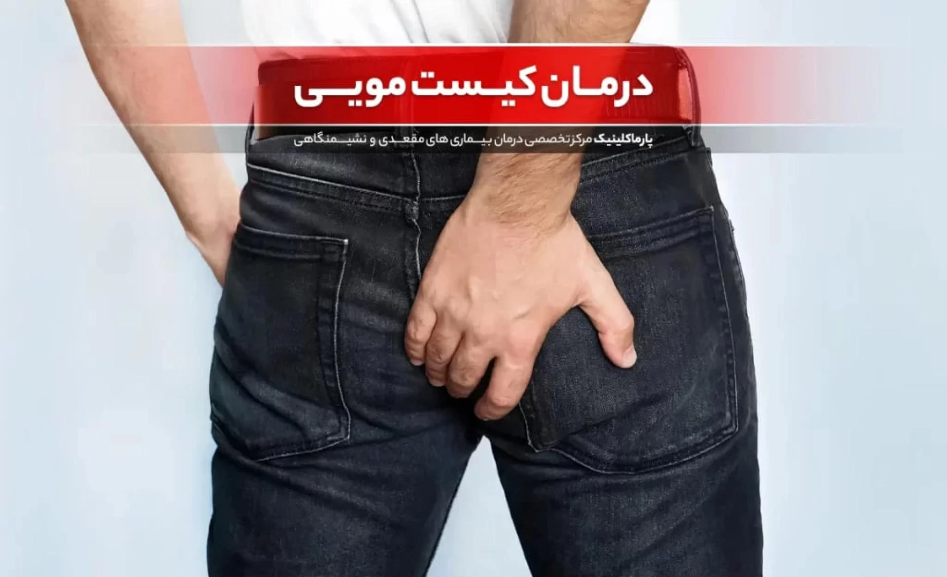 Hair Cyst Treatment with Laser in One Session | 100% Certain