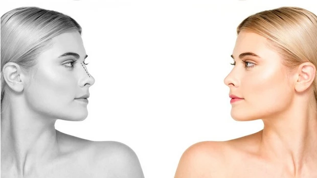 Harley Street Nose Job: Transforming Lives, One Nose at a Time
