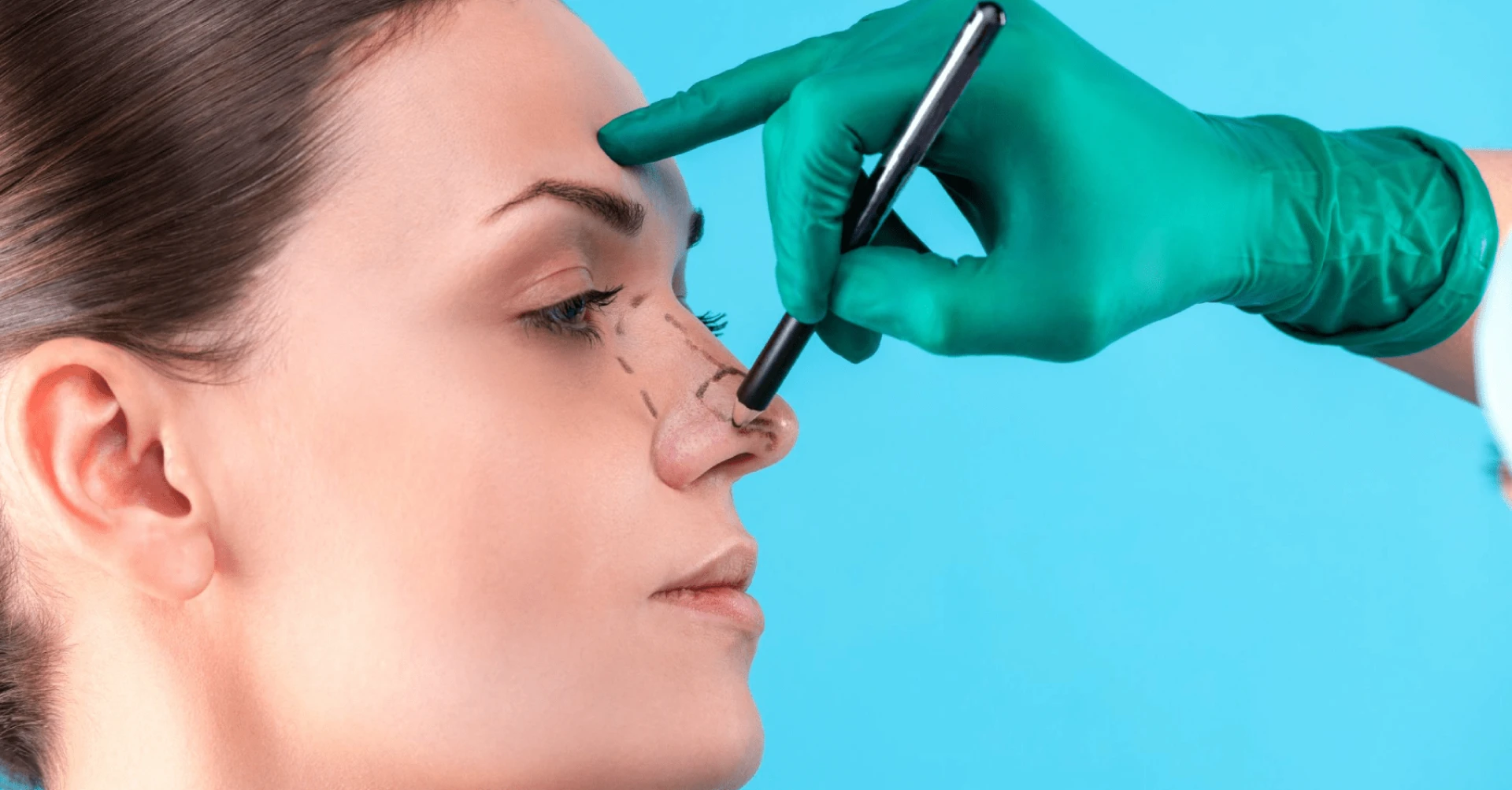 "What to Expect from Rhinoplasty in Riyadh: Your Questions Answered"