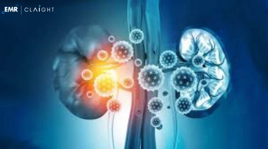 Global Acute Kidney Injury Treatment Market Size, Share, Growth, Trends, Report